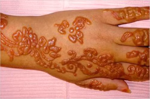 Xăm Henna đẹp nhưng lại tồn tại những ẩn họa khôn lường ảnh hưởng trực tiếp tới sức khỏe, vậy nên hãy cân nhắc trước khi thực hiện.