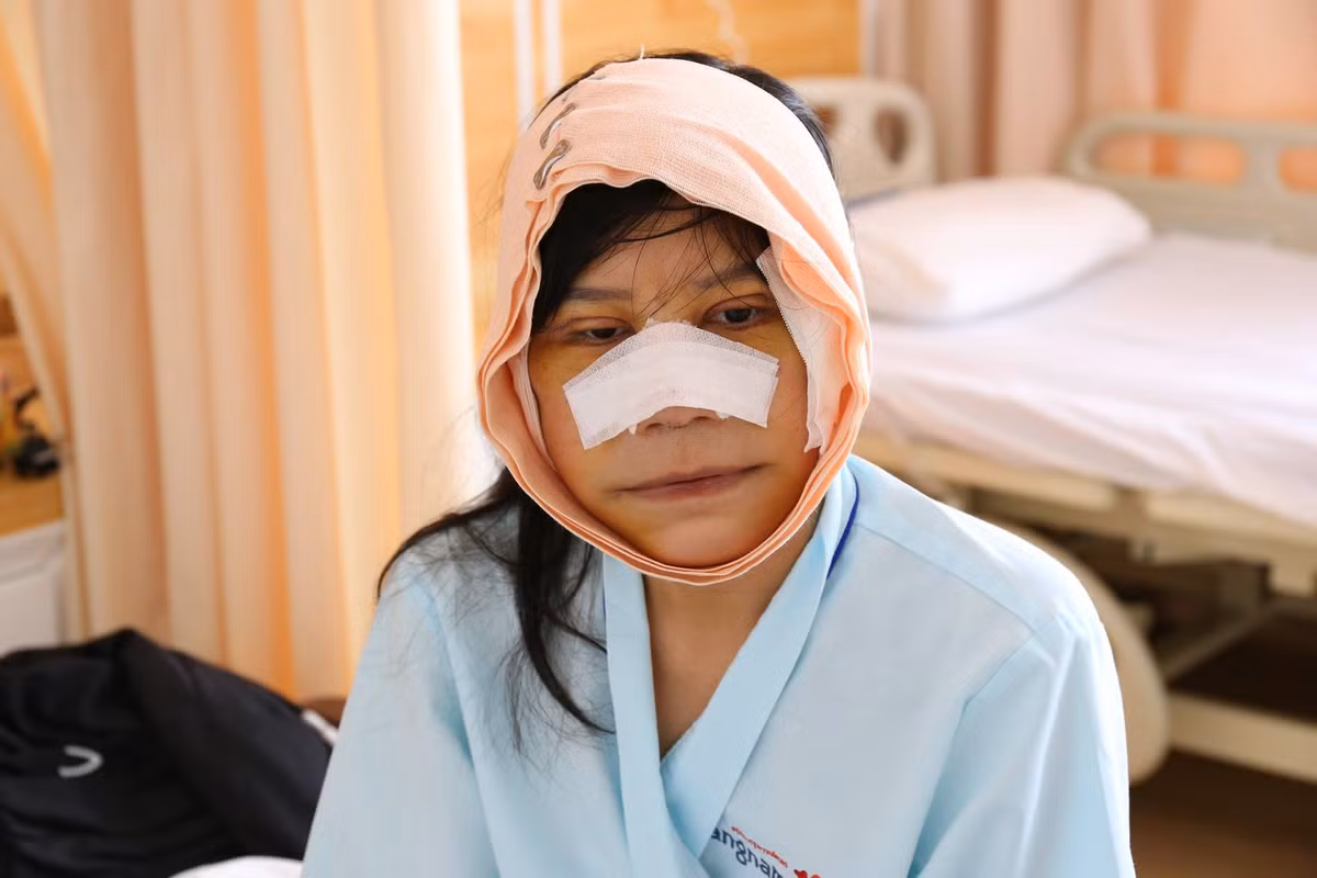 Tuy nhiên, "phép màu" đã tới với cô gái này khi cô đạt giải nhì trong chương trình “Hành trình lột xác 2017″, Như đã có thể thay đổi cuộc sống của mình với tấm vé phẫu thuật thẩm mỹ miễn phí do các bác sĩ đến từ Hàn Quốc thực hiện.