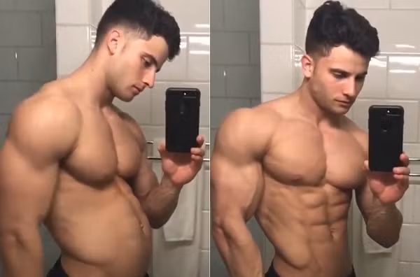 Chang trai 9X bien bung mo thanh 6 mui trong nhay mat