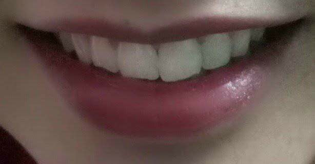 Bên cạnh việc đưa ra những lời khuyên, các dân mạng còn khoe bờ môi gợi cảm của mình ngay dưới phần bình luận, với mục đích giúp cô gái kia có thêm động lực để tự tin và mạnh tay đẩy lùi ria mép.