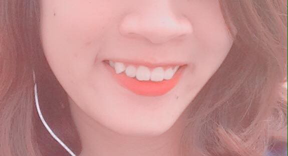 Phía bên dưới phần bình luận của bài viết này, nhiều bạn nữ cũng đã đưa ra lời khuyên để giúp cô gái này xóa bỏ ria mép như triệt nang lông mép, cạo đi hay dùng công nghệ để xử lý.