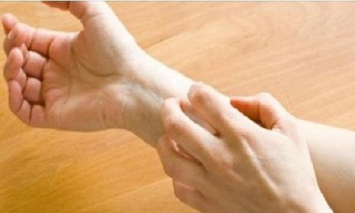 Hết ngay dị ứng chỉ với 1 ly nước Het ngay di ung chi voi 1 ly nuoc