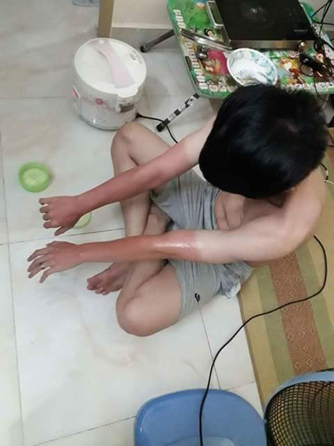 Chiếc găng tay thay đổi màu da có 1-0-2 và chỉ xuất hiện trên thị trường khi mùa hè tới.