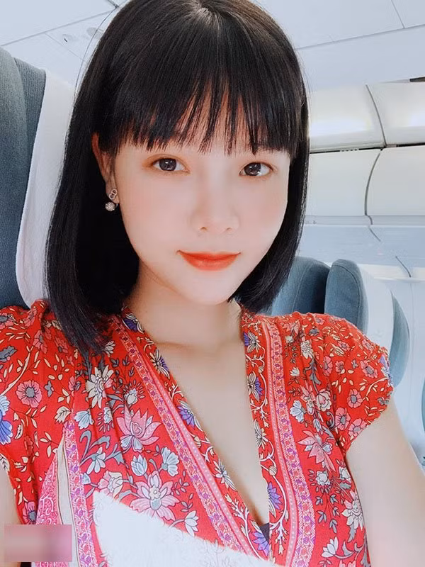 Bức hình chụp lại khuôn mặt sưng vù tới mức khó nhận ra của Kỳ Hân sau khi vừa đụng chạm "dao kéo" từng khiến rất nhiều người không khỏi giật mình hoảng hốt.