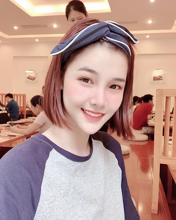 Không chỉ khoe ảnh "dao kéo", Kỳ Hân đồng thời đính kèm dòng chia sẻ: "Sắp có đôi mắt to tròn như mong muốn với nếp mí rõ rõ luôn rồi các chị ơi. Chờ em 5 ngày nữa cắt chỉ là sẽ rõ luôn".