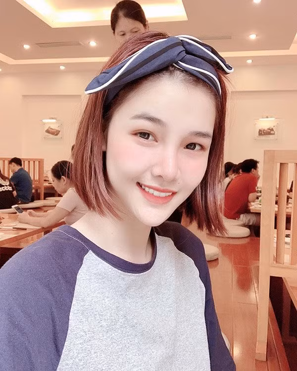 Không chỉ khoe ảnh "dao kéo", Kỳ Hân đồng thời đính kèm dòng chia sẻ: "Sắp có đôi mắt to tròn như mong muốn với nếp mí rõ rõ luôn rồi các chị ơi. Chờ em 5 ngày nữa cắt chỉ là sẽ rõ luôn".