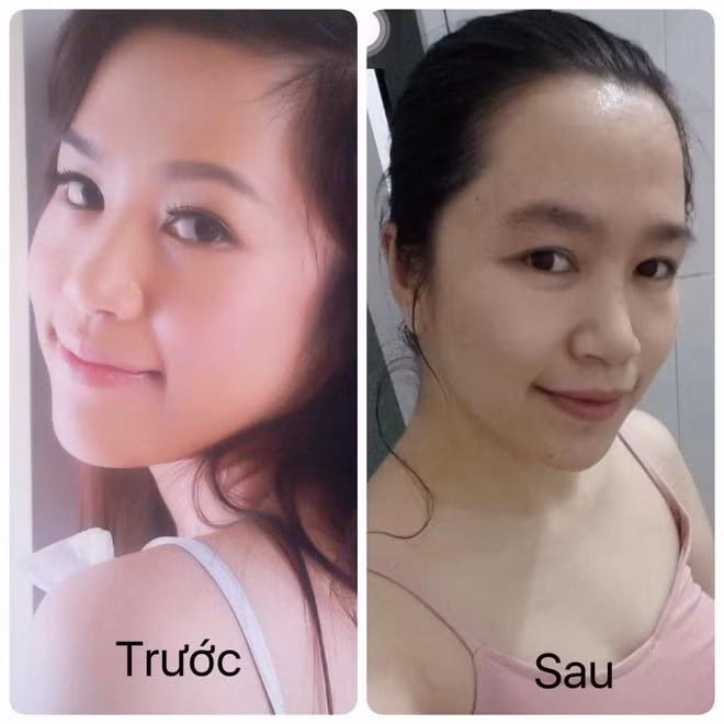 Điều mà nhiều chị em muốn nói lên rằng, họ đã phải hy sinh nhan sắc của mình để có được hạnh phúc trăm năm.