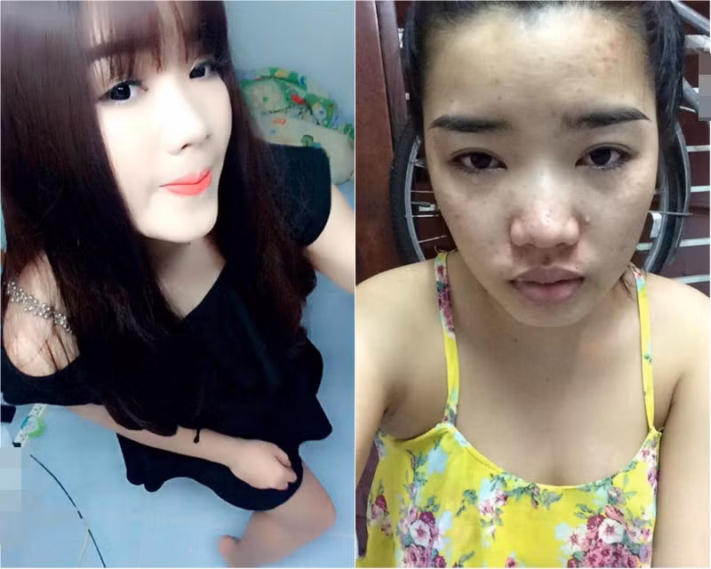 Sau sự kiện cô gái sống ảo quyết định lộ bộ mặt thật đầy mụn với người yêu làm cư dân mạng dấy lên làn sóng điều tra về những phi vụ của những cô gái mặt mụn lột xác thành hot girl nhờ son phấn và ứng dụng chỉnh ảnh.