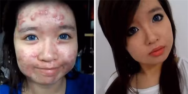 Vì vậy nhiều cô nàng đã dùng kem nền, kem che khuyết điểm và đánh một lớp phấn thật dày để dấu những "em" mụn vô duyên kia. Nhưng các nàng không biết rằng chính việc make up đậm cũng như sử dụng kem nền khiến tình trạng mụn trở nên tồi tệ hơn lúc trước.