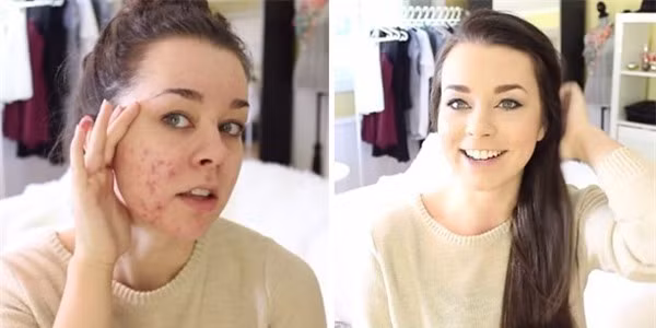 Mặt mộc khác biệt “một trời một vực” nhờ trang điểm.