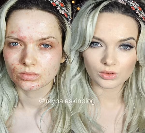 Ngoài việc sử dụng những loại mỹ phẩm thì còn một cách nữa để giúp các cô nàng mặt mụn hóa hot girl đó là nhờ các ứng dụng chụp ảnh "thần thánh".