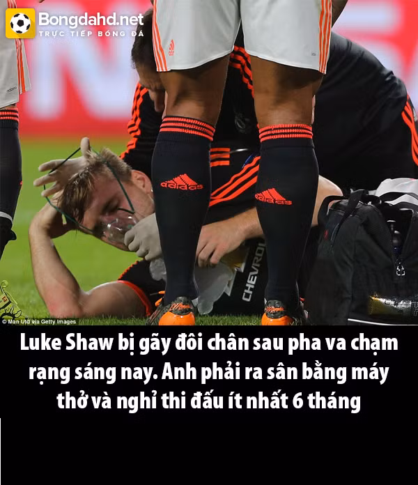 Chấn thương này đã cướp Luke Shaw khỏi Man United tới 6 tháng.