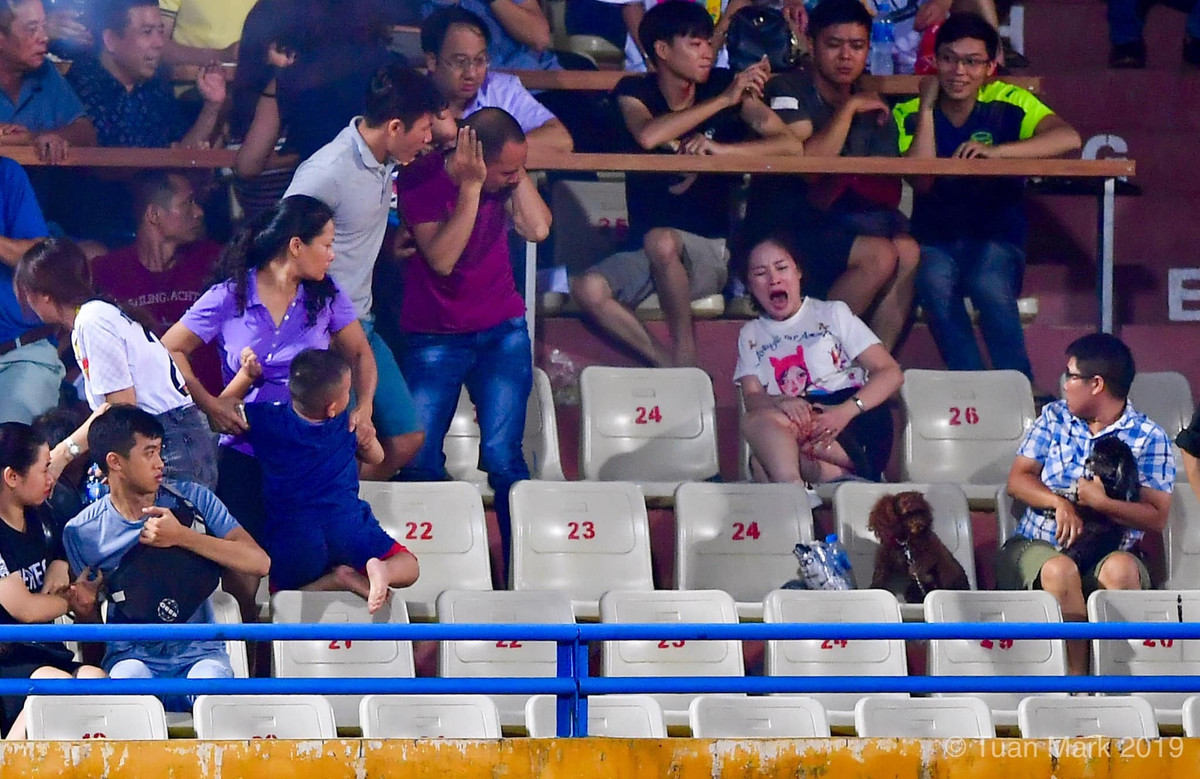 Sau khi trúng pháo sáng CĐV Nam Định bắn, fan nữ kém may mắn bị rách phần đùi khá to và được chuyển ngay vào bệnh viện để cấp cứu. Ảnh: Tuấn Mark