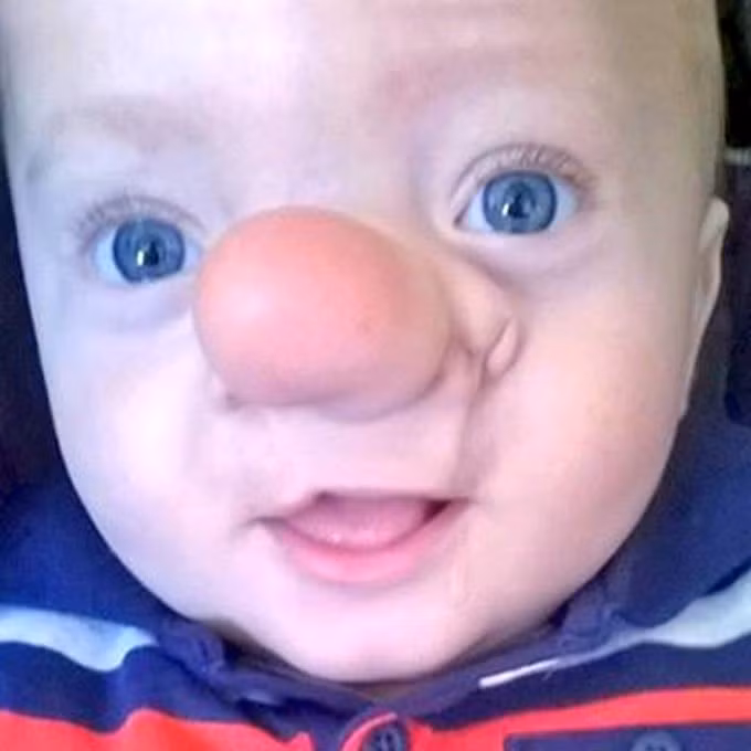 Cau be song sot ky dieu voi nao o trong mui-Hinh-3