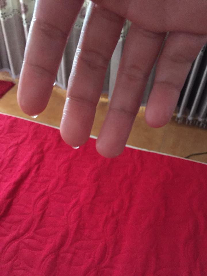 Thành viên Minh An chia sẻ: ''Từ trước giờ chẳng dám nắm tay ai. Đi chơi với người yêu thì phải xịt thuốc kiềm chế mồ hôi rồi phủ phấn rôm lên cho bớt. Phần vì ngại, phần vì sợ đánh giá là thiếu vệ sinh. Đặc biệt là vào mùa hè thì khỏi phải nói, ngồi không thôi mà cũng đầm đìa''.