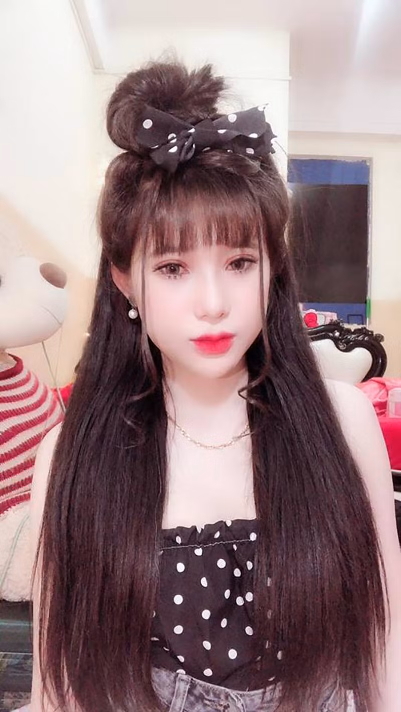 Su Any chia sẻ: "Thời bé, mình béo và đen lắm, lại là người dân tộc thiểu số nên luôn bị các bạn tẩy chay. Mình chẳng làm gì cũng bị các bạn mang ra làm tâm điểm chọc ghẹo, giễu cợt. Họ chê mình xấu xí, đen đúa, nhìn bẩn bẩn, còn xúc phạm đến cả gia đình và dân tộc mình nữa".