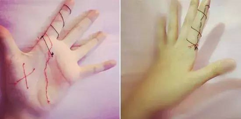 Được biết, trào lưu này bắt nguồn từ nhân vật Juzo Suzuya trong truyện Tokyo Ghoul, một trong những bộ manga bán chạy nhất của Nhật Bản. Trong truyện, Suzuya có thói quen tự thêu bằng sợi chỉ màu đỏ lên người.