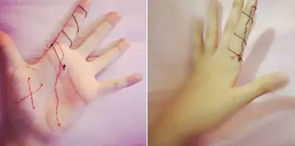 Được biết, trào lưu này bắt nguồn từ nhân vật Juzo Suzuya trong truyện Tokyo Ghoul, một trong những bộ manga bán chạy nhất của Nhật Bản. Trong truyện, Suzuya có thói quen tự thêu bằng sợi chỉ màu đỏ lên người.