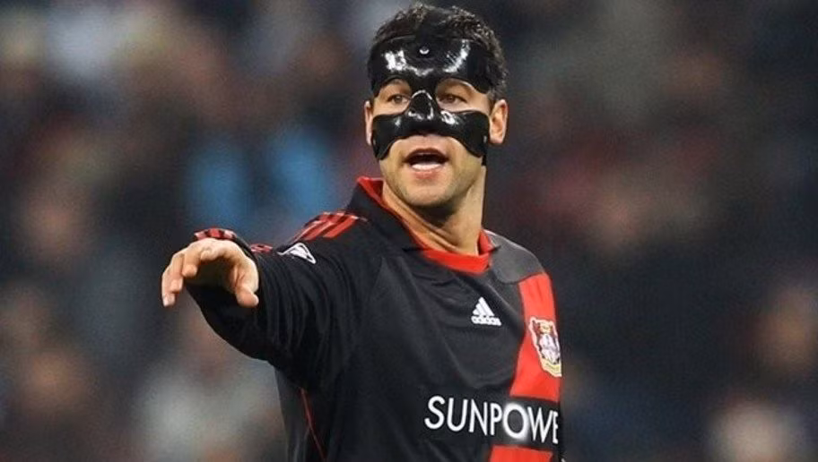 Thời điểm khoác áo CLB Bayer Leverkusen vào năm 2011, Cựu thủ quân đội tuyển Đức cũng từng phải thi đấu với chiếc mặt nạ bảo vệ. Gương mặt của tiền vệ này trông hầm hố hơn rất nhiều khi sử dụng thêm chiếc mặt nạ.