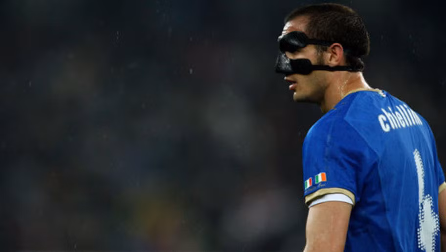 Trong chiến thắng 2-0 của Italy trước Montenegro ở vòng loại WorldCup 2010. Trung vệ Chiellini của Juventus đã bị vỡ mũi và đó cũng là khoảng thời gian cầu thủ 31 tuổi phải làm quen với chiếc mặt nạ Zorro.
