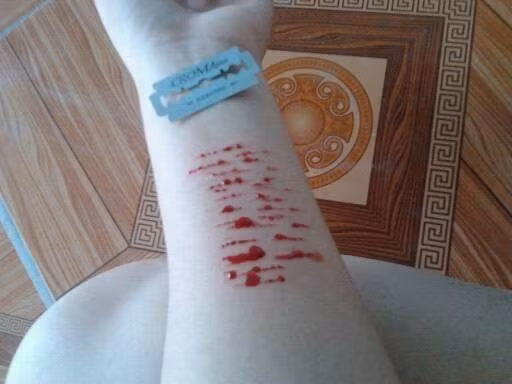 Cụ thể, một nữ sinh Nghệ An có tên P.N đăng tải clip dùng dao lam tự rạch tay đến rướm máu lên trang cá nhân với dòng chú thích "Cứ chia tay tao đi". Clip này nhanh chóng thu hút một lượng lớn lượt xem và bình luận từ cư dân mạng.