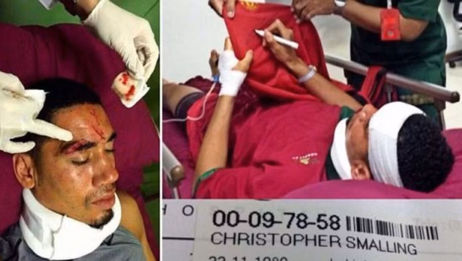 Mới đây, trên trang chủ của Man United đăng tải hình ảnh Chris Smalling đã bị ngộ độc thực phẩm dẫn đến bị ngất hôm chủ nhật vừa qua. Thế nhưng theo thông tin từ cô bạn gái Sam Cooke thì nguyên nhân là do ngôi sao bóng đá nước Anh này đi lướt sóng và bị sứa độc tấn công.