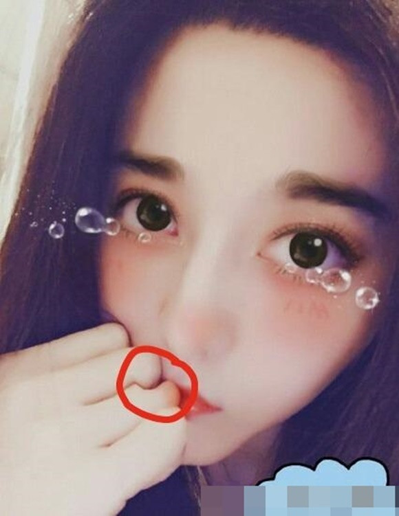 Ngón tay của Phạm Băng Băng như bị mất một mảng thịt.