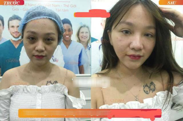 Cái tên Hera Kiều Anh thời gian qua cực nổi trên mạng xã hội khi vụ lùm xùm bị bồ cũ dọa tung clip nóng thu hút sự chú ý cực lớn từ dân mạng. Im lặng chờ "bão qua", mới đây nữ streamer này bất ngờ trở lại khi xuất hiện tại một thẩm mỹ viện để "trùng tu" nhan sắc.