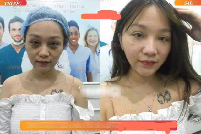 Cái tên Hera Kiều Anh thời gian qua cực nổi trên mạng xã hội khi vụ lùm xùm bị bồ cũ dọa tung clip nóng thu hút sự chú ý cực lớn từ dân mạng. Im lặng chờ "bão qua", mới đây nữ streamer này bất ngờ trở lại khi xuất hiện tại một thẩm mỹ viện để "trùng tu" nhan sắc.