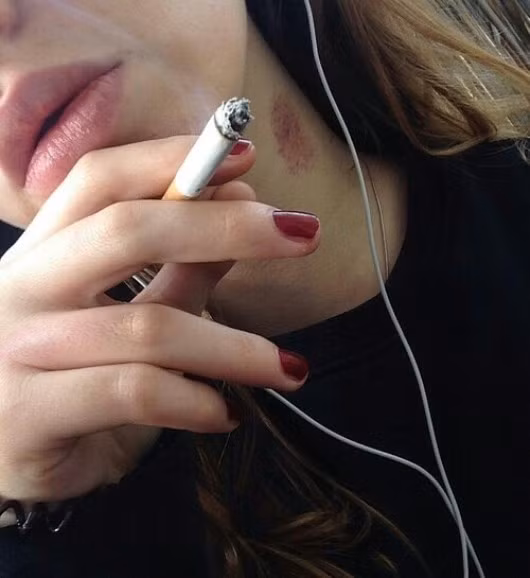 Dù đã được cảnh báo trước, thế nhưng rất nhiều bạn trẻ vẫn tiếp tục thử nghiệm việc hôn kiểu Hickey Kiss với đối tác của mình.