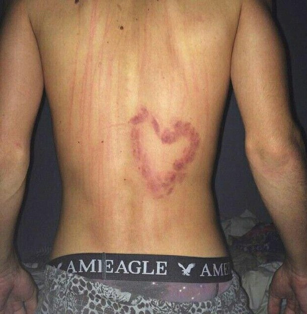 Hình ảnh hôn kiểu Hickey Kiss hình trái tim của một thành viên trên mạng xã hội.