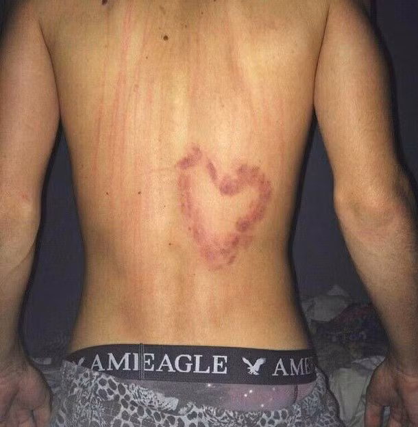 Hình ảnh hôn kiểu Hickey Kiss hình trái tim của một thành viên trên mạng xã hội.