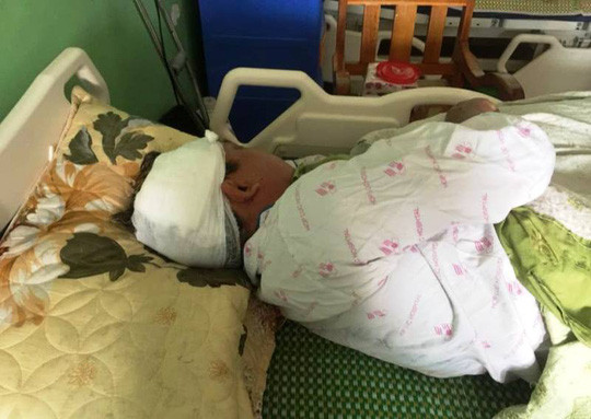 Con do bit mat xong vao nha, chem nguoi dan ong nhap vien