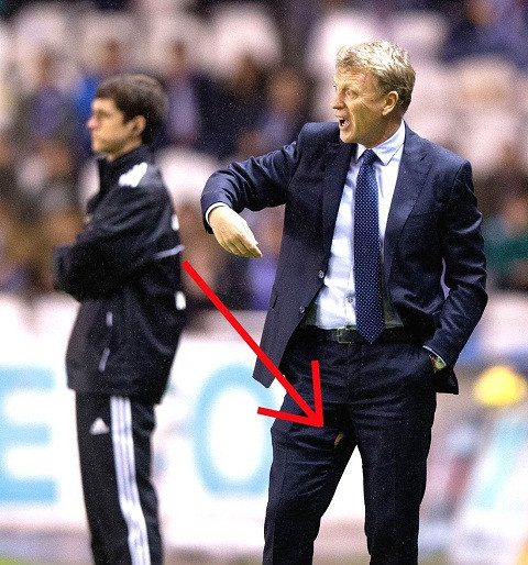 David Moyes bị rách quần. Anh: Goal.com/ Independent.