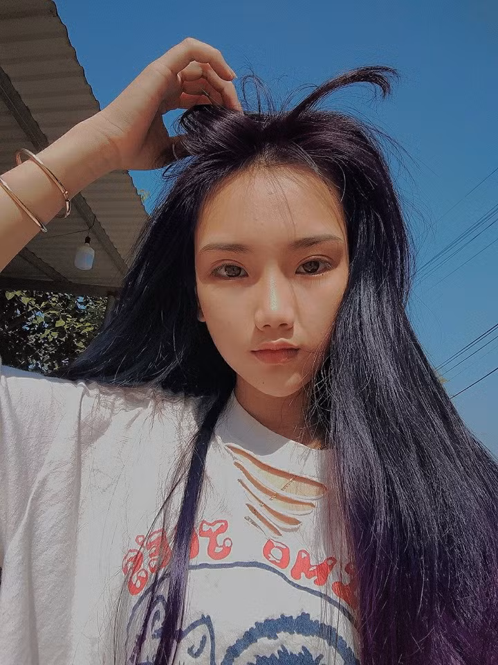 Chẳng cần ồn ào lên tiếng đáp trả dư luận, Kim Anh đã nhẹ nhàng cho đăng tải những bức ảnh khi còn bé của mình khiến ai cũng phải câm nín. Thậm chí, nhiều người còn nhận xét rằng nữ sinh "dậy thì thành công" đã đẹp "nét nào ra nét ấy".