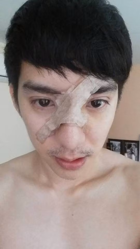 Để tự giúp mình thoát khỏi những tự ti về hình thể cũng như khuôn mặt Paya đã quyết định tới Hàn Quốc để phẫu thuật thẩm mỹ để có một khuôn mặt mịn màng cùng hàm răng thẳng tắp.