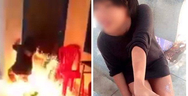 Có trường hợp nạn nhân bị bỏng phải ghép da. Thậm chí, một thanh niên 15 tuổi ở New York (Mỹ) đã bị thiêu đến chết vì bạn bè không dập lửa thành công.