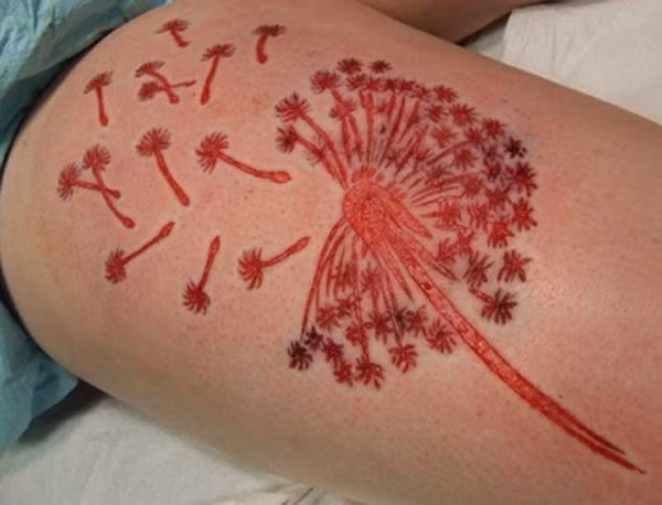 Theo cảnh báo của các chuyên gia y tế thì việc xăm hình có thể dẫn đến nguy cơ mắc bệnh rất cao, đặc biệt là xăm khoét thịt. Nhẹ thì dị ứng thông thường, nặng thì có thể dẫn đến hoại tử, ảnh hưởng đến các bộ phận khác trong cơ thể.