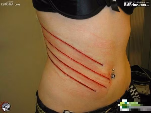 Giới mê chơi xăm sẹo quan niệm đây mới là thú chơi đích thực, là "tuyệt tác" của chính bản thân chứ không phải là tác phẩm nghệ thuật của người thợ xăm, bởi để có được hình xăm sẹo khổ chủ phải có gan chịu đau chấp nhận lột da, tạo thành sẹo hình.