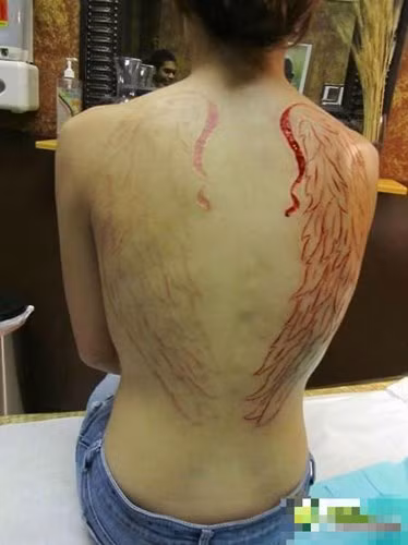 Thú vui quái đản này được giới trẻ coi là cách đem lại sự giải tỏa căng thẳng, vì khi máu chảy, cơ thể con người sẽ tiết ra những chất có tác dụng như thuốc an thần.