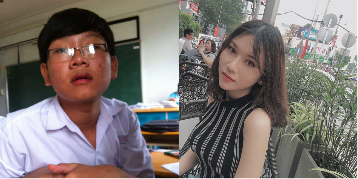 Mới đây, cô gái Sài Gòn 20 tuổi tên Ngọc Anh (20 tuổi, tên khai sinh là Nguyễn Việt Tuấn Anh) đã khiến dân mạng xôn xao khi công khai hình ảnh phẫu thuật chuyển giới của mình. Vốn sinh ra với thân xác nam giới, Ngọc Anh là minh chứng hùng hồn cho trào lưu "dậy thì thành công" của giới trẻ hiện nay.