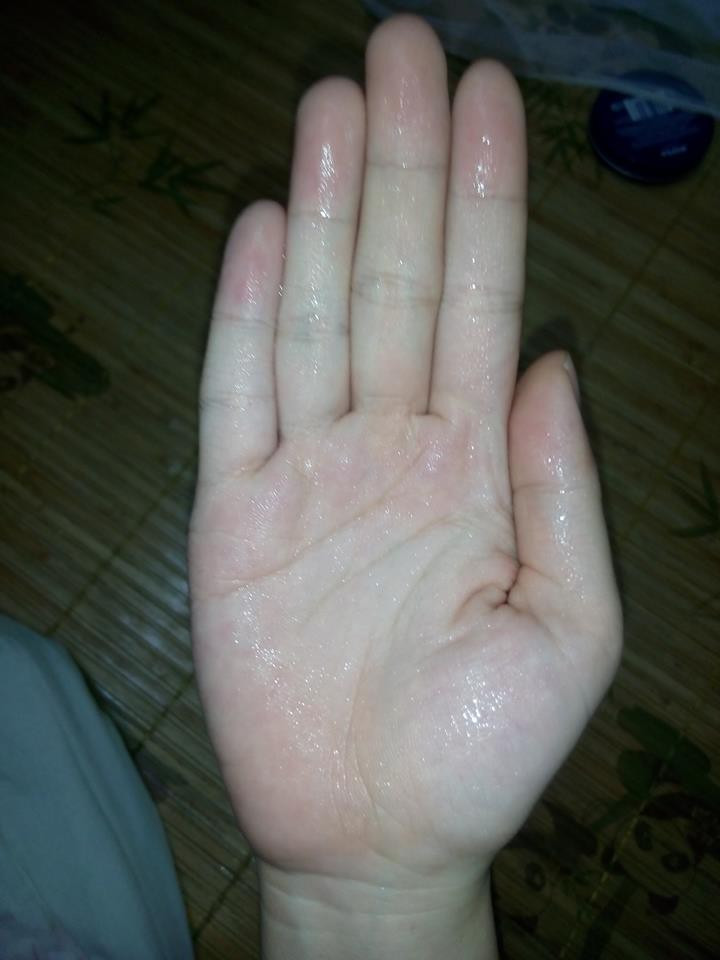 Mọi người cho rằng việc đổ mồ hôi tay khiến họ làm gì cũng khó ngay cả việc đơn giản như viết, mở nắm cửa, cầm nắm đồ vật... tất cả những việc hết sức bình thường này đều trở thành nhiệm vụ bất khả thi với những người có quá nhiều mồ hôi.