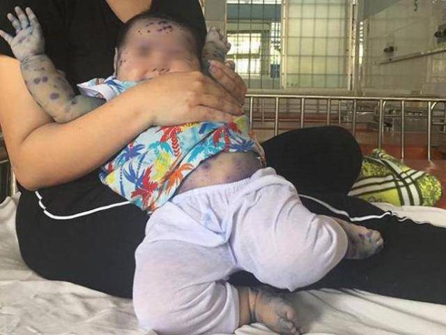 Theo bình luận của nhiều dân mạng: "Chị gái mặc áo mưa xanh với vẻ mặt thất thần tiều tụy, bịt khẩu trang kín mít trong khi cậu nhóc thì ngơ ngác nhìn mẹ. Nhìn đến là thương". Đa phần, các dân mạng đều có được một phút giây phì cười thoải mái vào cuối tuần.