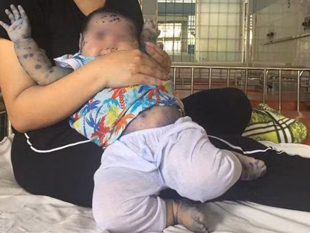 Theo bình luận của nhiều dân mạng: "Chị gái mặc áo mưa xanh với vẻ mặt thất thần tiều tụy, bịt khẩu trang kín mít trong khi cậu nhóc thì ngơ ngác nhìn mẹ. Nhìn đến là thương". Đa phần, các dân mạng đều có được một phút giây phì cười thoải mái vào cuối tuần.