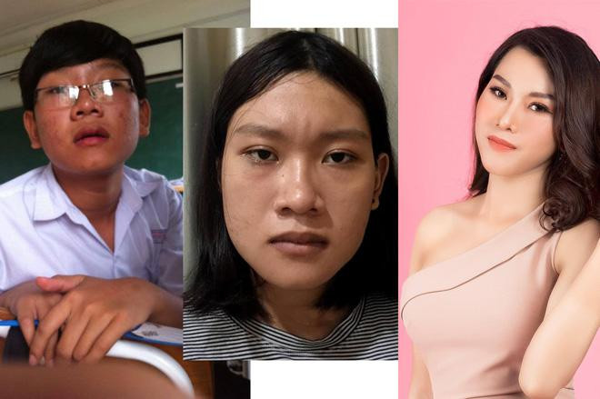 Những lần trong trang phục nữ cho Ngọc Anh cảm giác "được là chính mình" và khát khao được sống cuộc đời của một cô gái thực sự. Ngọc Anh quyết định sống trong hình hài của một cô gái với mái tóc giả, độn ngực, quần áo con gái, giày cao gót.