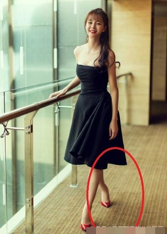 Chân phải của Thẩm Mộng Thần cong veo, teo tóp vì photoshop.