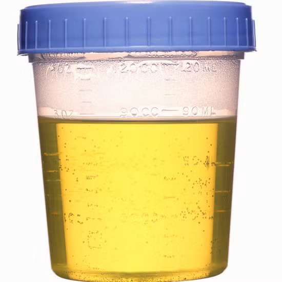 1. Nước tiểu giúp cầm máu, chống rong huyết và giảm co bóp tử cung cho phụ nữ sau sinh: Dùng nước tiểu của bé trai dưới 12 tuổi uống cùng nghệ tươi. Phụ nữ sau sinh gầy yếu, ho sốt, thổ huyết: Dùng nước tiểu còn nóng ấm ngày uống 200ml. Uống liên tiếp trong một tháng. Ảnh: soha.vn.