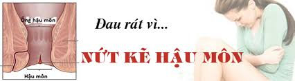 Do kẽ hậu môn bị viêm, nứt: Việc bị táo bón lâu ngày cũng gây chảy máu khi đại tiện do phải gắng sức rặn gây nứt và viêm nhiễm hậu môn. Ảnh: benhtrihn.vn.