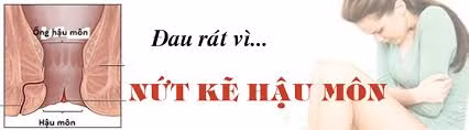 Do kẽ hậu môn bị viêm, nứt: Việc bị táo bón lâu ngày cũng gây chảy máu khi đại tiện do phải gắng sức rặn gây nứt và viêm nhiễm hậu môn. Ảnh: benhtrihn.vn.