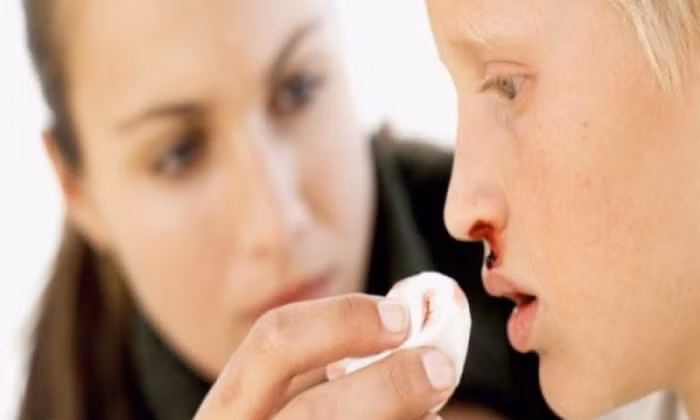 4. Ngó sen, mật ong. Dùng ngó sen tươi ép lấy 150ml nước, cộng với 30g mật ong quấy đều và uống. Công dụng chữa khỏi bệnh chảy máu cam. Bài thuốc từ ngó sen này già trẻ đều dùng được, không phải kiêng kị gì. Ảnh: Giadinh.